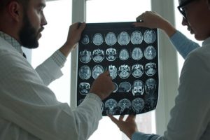 Traumatic Brain Injury Accident attorney
